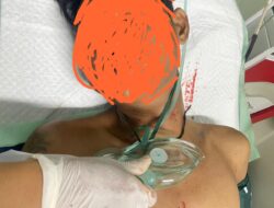 Hantam Futura, Pengemudi Sepeda Motor ini Meninggal Dunia